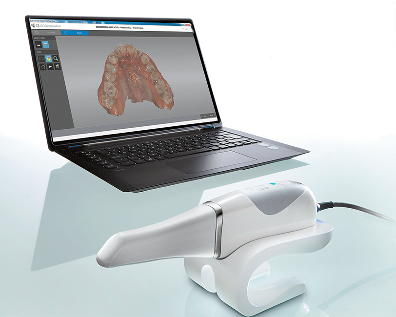 Carestream CS3600 Intraoral Scanning In The Clinic Universo
