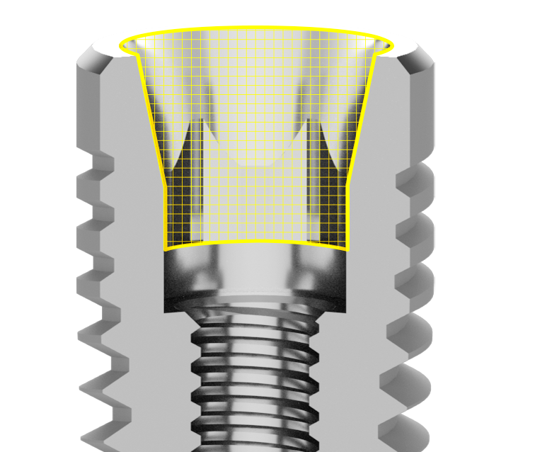 YV_37_11_SEZ_R_PLANT-SEZ